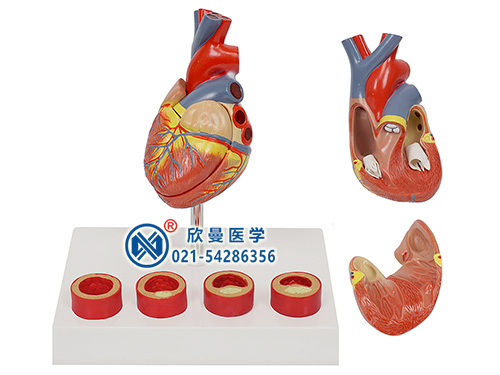 XM-402K动脉粥硬化带血栓模型
