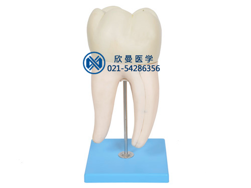 磨牙有两个牙根模型XM-908
