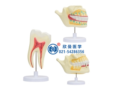 乳牙、恒牙牙列模型XM-912
