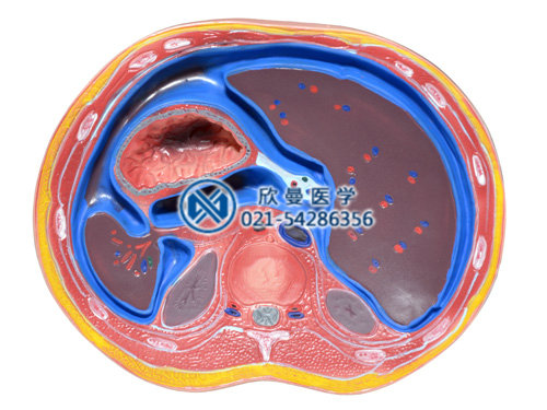 腹腔横断模型XM-506B

