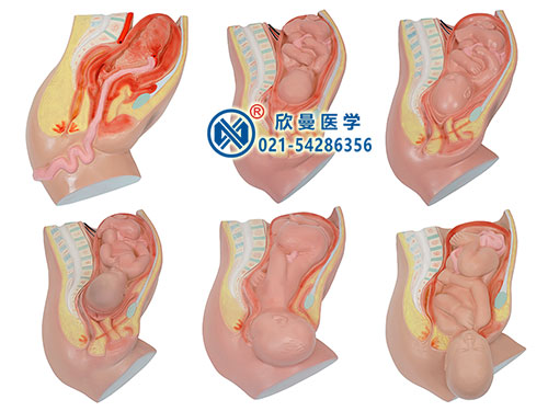 XM-814足月胎儿分娩过程模型
